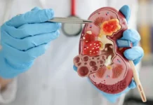 Ciri-ciri Ginjal Rusak