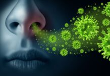 Waspadai Influenza A, Penyakit Menular yang Bisa Sebabkan Komplikasi Serius